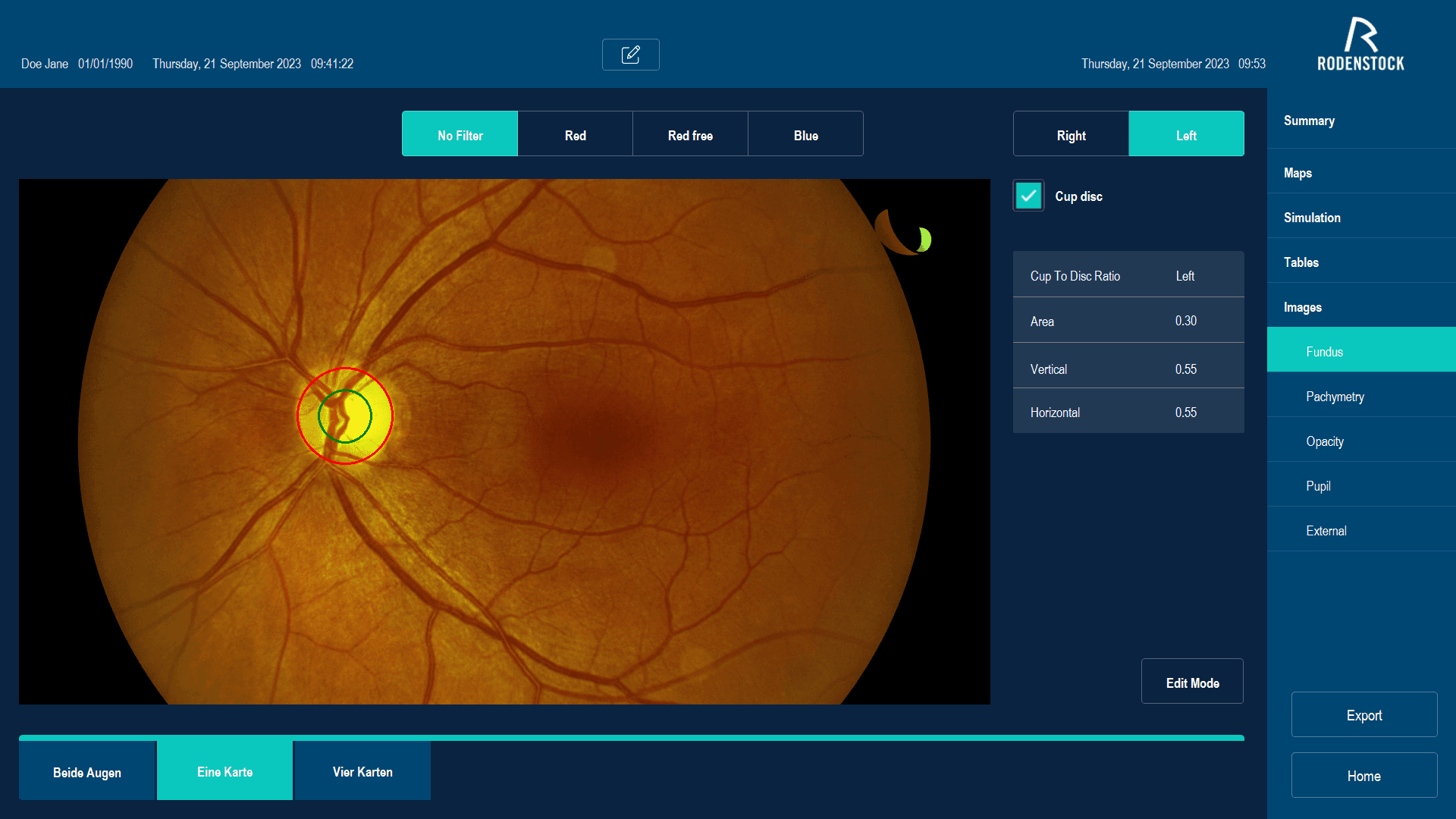 Pregled očesnega ozadja - slika mrežnice in vidnega živca
